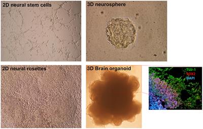 Neural Lineage Differentiation From Pluripotent Stem Cells to Mimic Human Brain Tissues